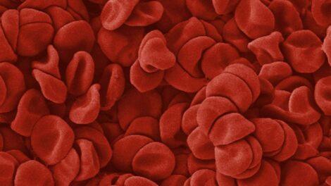 Blood Cells, SEM. Anne Weston, Francis Crick Institute. Source: Wellcome Collection.