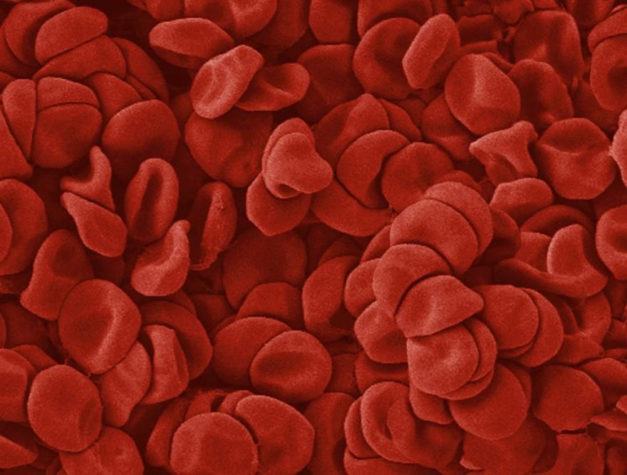 Blood Cells, SEM. Anne Weston, Francis Crick Institute. Source: Wellcome Collection.