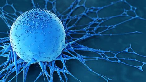 Illustration of a blue cancer cell