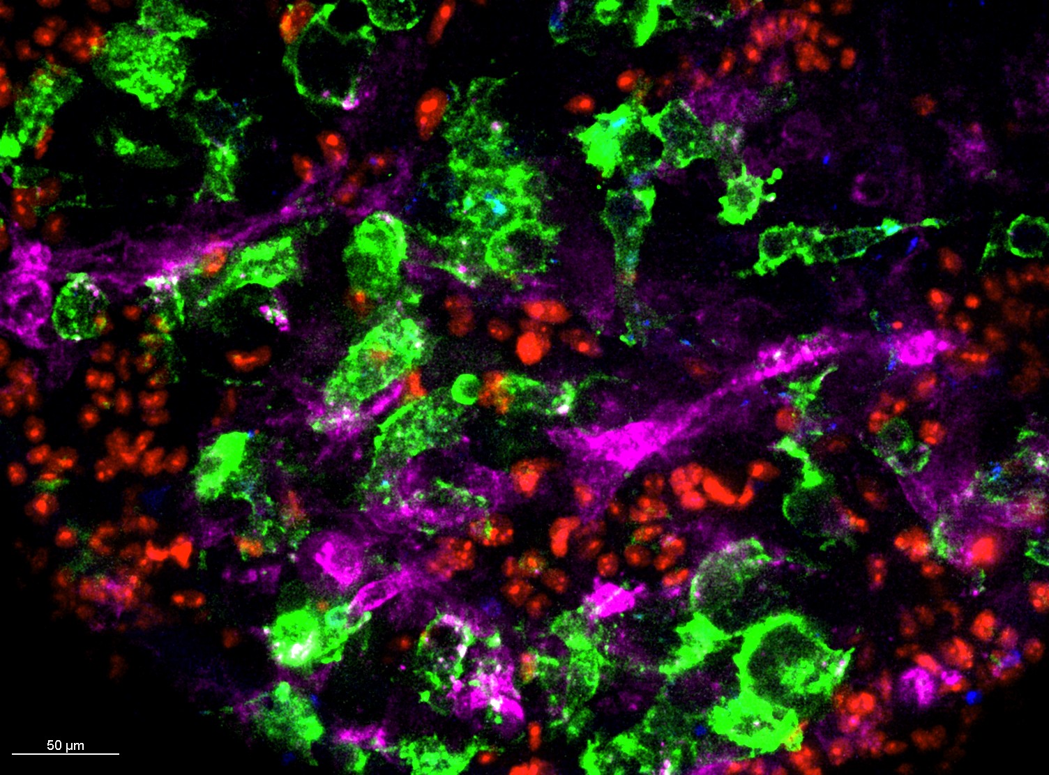 Microscope image of ovarian cancer pentacultures. Cancer cells are shown in red, with macrophages (CD14) in green, fibroblasts (CD90) in pink and the extracellular matrix (FN1) in blue. For more details, see the original paper: Malacrida et al. <i>Nat. Commun.</i> (2026).</p>