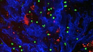 Microscope image of cell tissue, with cancer cells in red, T cells in green and fibronectin (an extracellular matrix protein) in blue. Credit: Pearce Lab.